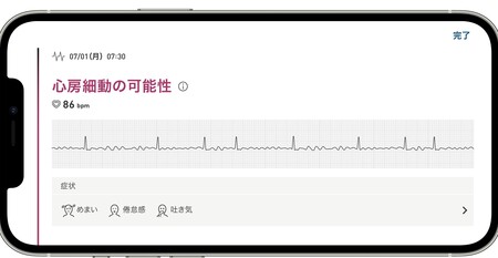 症例から学ぶ心電図活用法 もっと活かせる心電図  /金原出版/森博愛（単行本） 10年悩んだ不整脈、スマートウオッチが記録 医療・健康活用