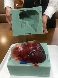 デジタルモールド メディカル使用模型 第一弾　肝臓モデルを販売開始