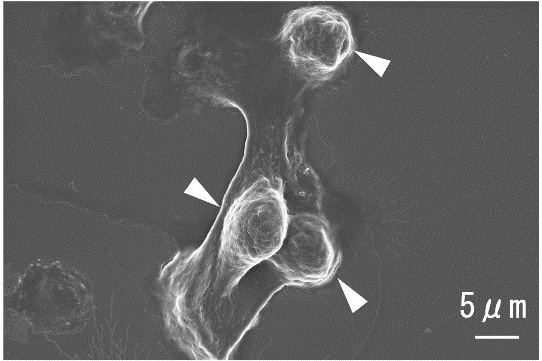 新しい歯周病治療薬を開発 | 新潟大学のプレスリリース | 共同