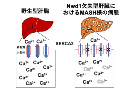 脂肪肝炎発症メカニズムの一端を発見