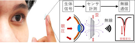 眼圧を高感度に無線計測するスマートコンタクトレンズを開発