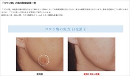コウジ酸の臨床試験結果