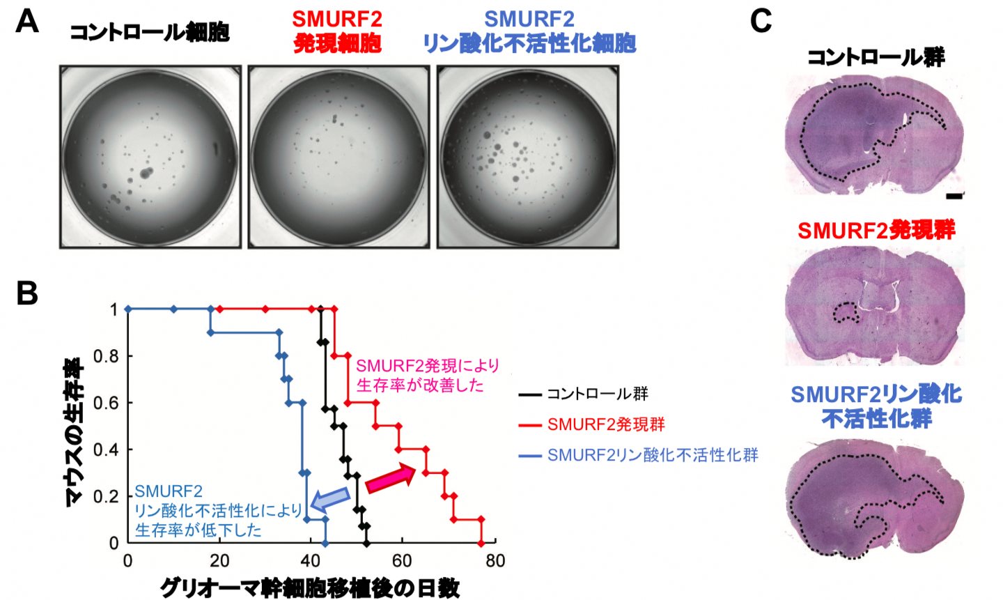 がん幹細胞の機能を制御する スイッチ を発見 信濃毎日新聞デジタル 信州 長野県のニュースサイト