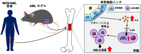 血液のがん・白血病の新しい治療標的を同定！