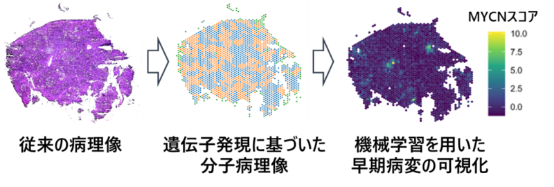 前がん病変の遺伝子発現で肝発がんのリスクを予測 | 岐阜大学のプレス