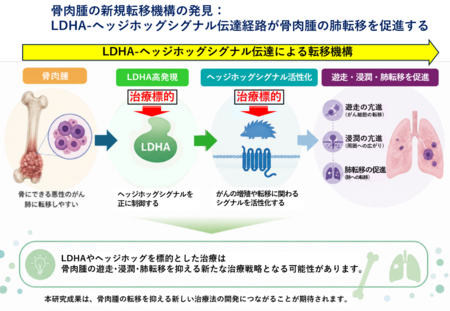 骨肉腫の「肺転移」を抑制するメカニズムを解明：骨肉腫の新規治療標的を発見