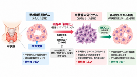 甲状腺未分化がんの発生に、がん細胞の“初期化”が関わることを発見 iPS細胞の技術を応用したマウスモデルで解明