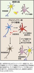 グリア細胞での糖代謝促進がアルツハイマー病の治療戦略に！？