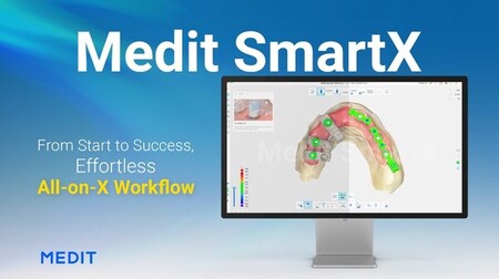 Medit、新たなAll-on-Xソリューション「Medit