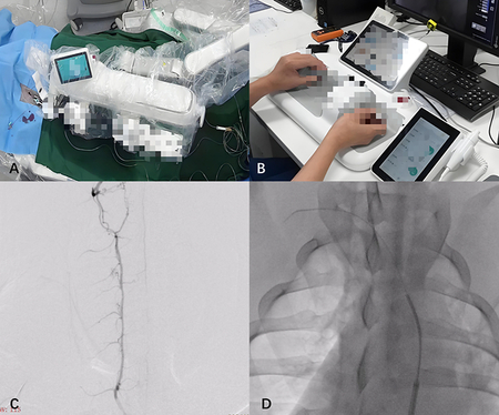 [China's Voice] Preclinical Animal Study: Domestic Neurointerventional Robotic System PANVIS STAR® Completes Validation of Five Major Neurointerventional Procedures