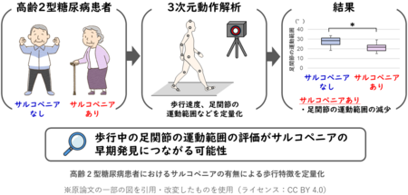 高齢2型糖尿病患者のサルコペニアの早期発見に有用な歩行指標を明らかに